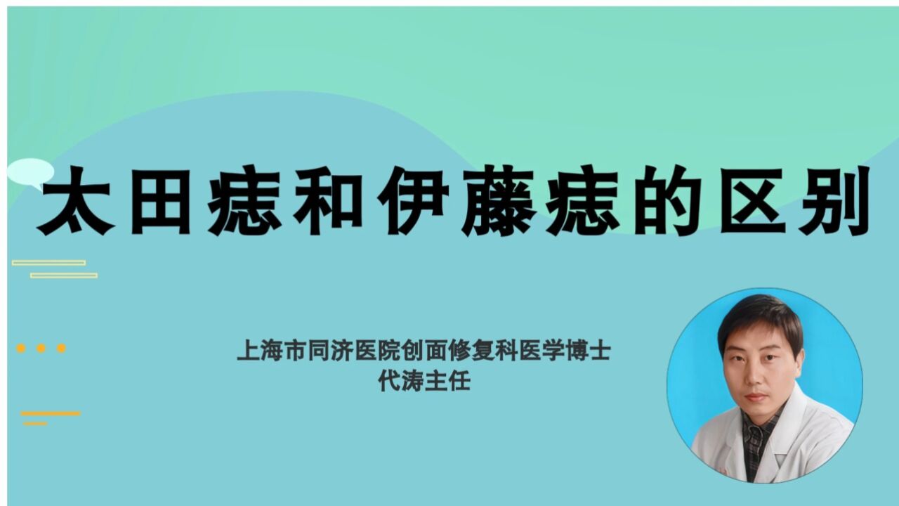 太田痣和伊藤痣的区别