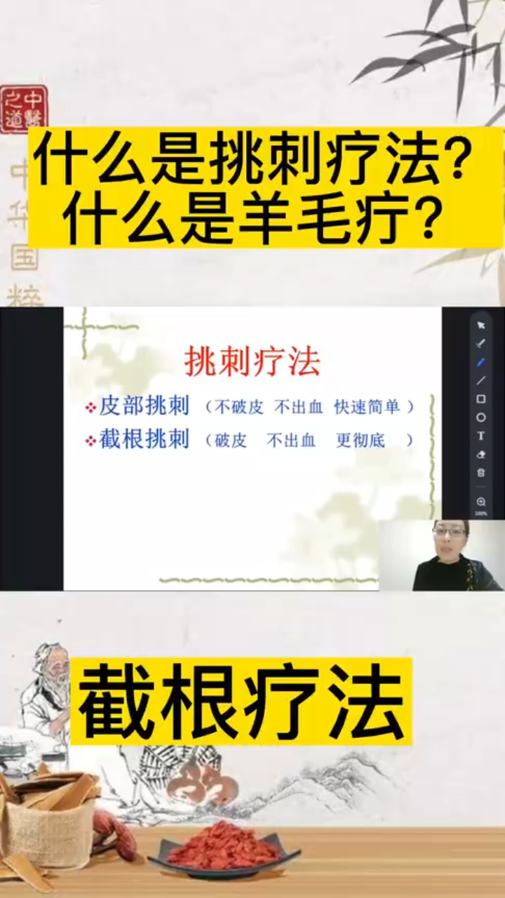 孙利群:什么是挑刺疗法?什么是羊毛疔?