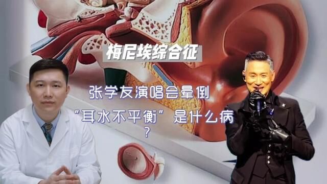 张学友演唱会晕倒,自诉“耳水不平衡”,原来是梅尼埃综合征#张学友因耳水不平衡跌倒 #小荷健康问专家 #每天跟我涨知识