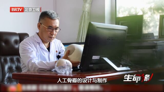 医生为男孩进行头骨扫描,组建颅骨模型,为其与其他医生讨论方案