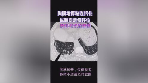 医学影像 