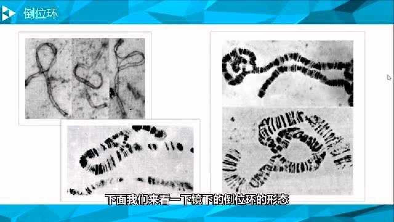 染色体倒位(检验141)_高清1080P在线观看平台_腾讯视频