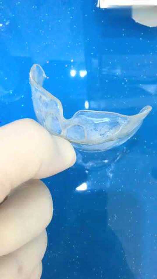 前庭盾纠正儿童口腔坏习惯