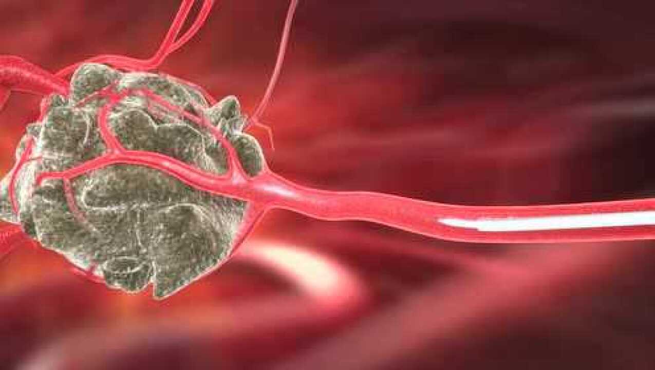 高清1080P在线观看平台_腾讯视频
