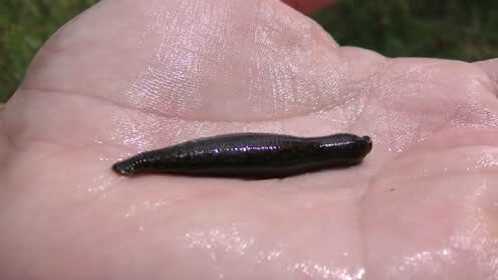 水蛭又名吸血虫,老外在实验它们的威力,果然名符其实