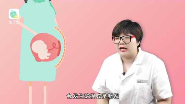 产后修复师教你正确认识妊娠纹,孕期产后的宝妈又如何进行护理?