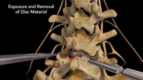 看了下午发的脊髓神经和椎间盘的解剖图