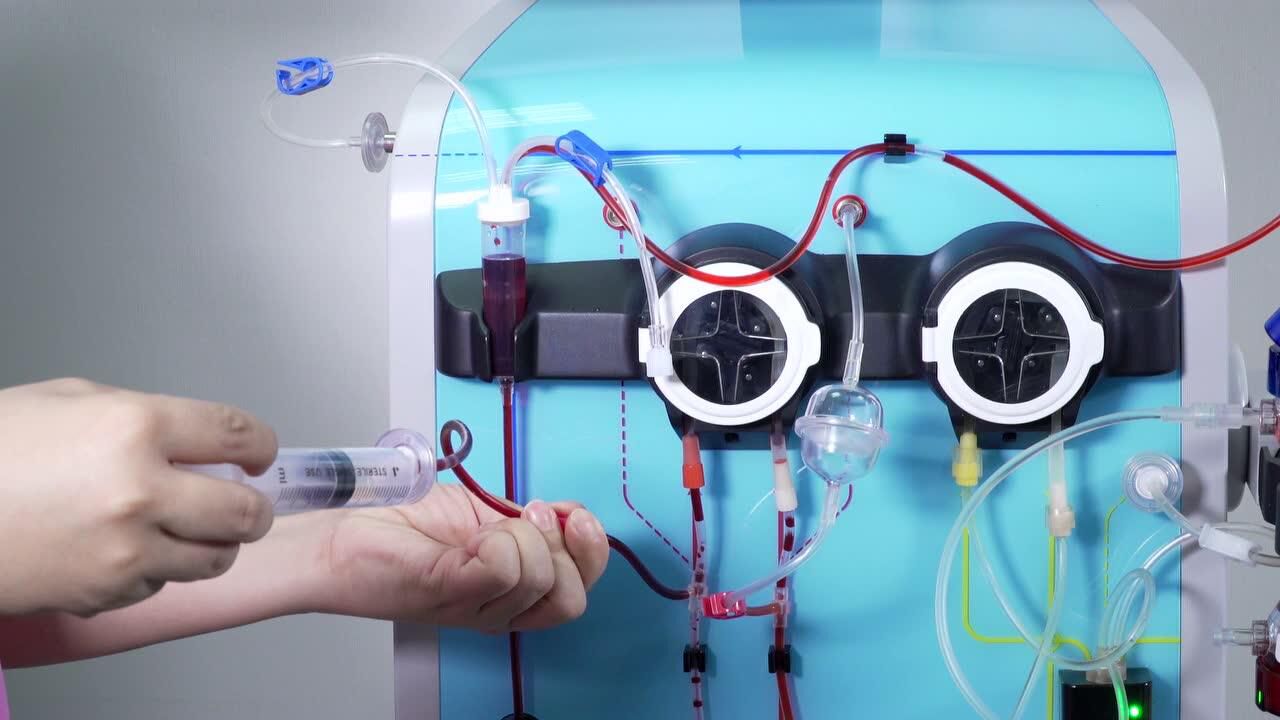心衰超滤脱水装置操作视频