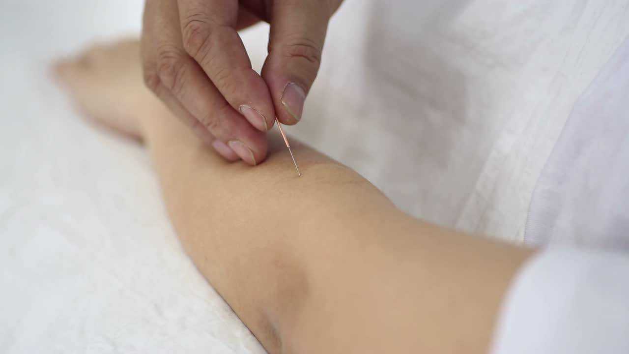 飞经走气针法—青龙摆尾