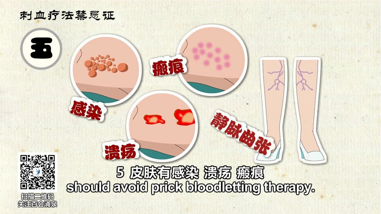 刺血疗法禁忌症_高清1080P在线观看平台_腾讯视频