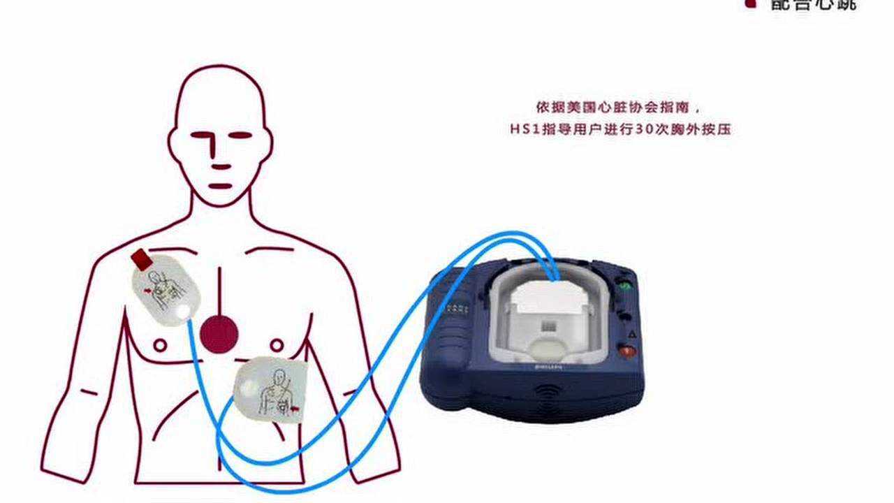 AED除颤仪使用指导介绍_高清1080P在线观看平台_腾讯视频