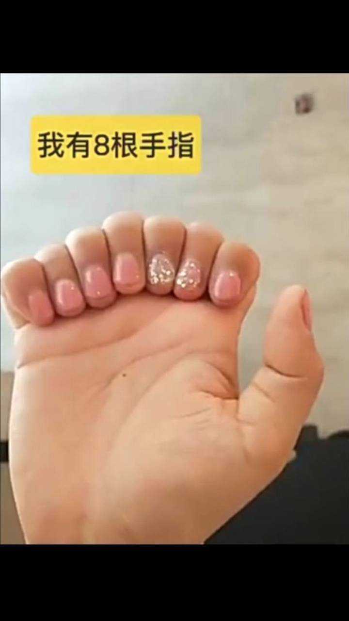 你们见过8个手指的人吗?