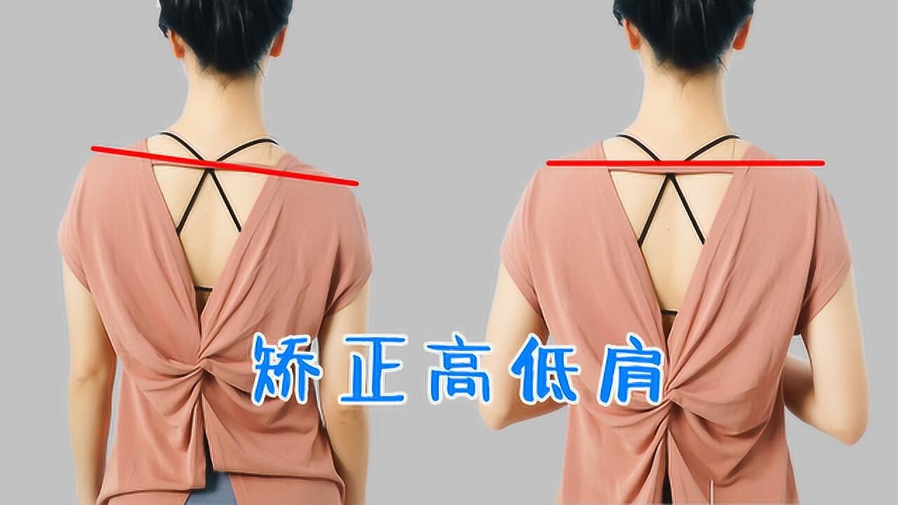 高低肩成了普遍体态日常该如何矫正高低肩