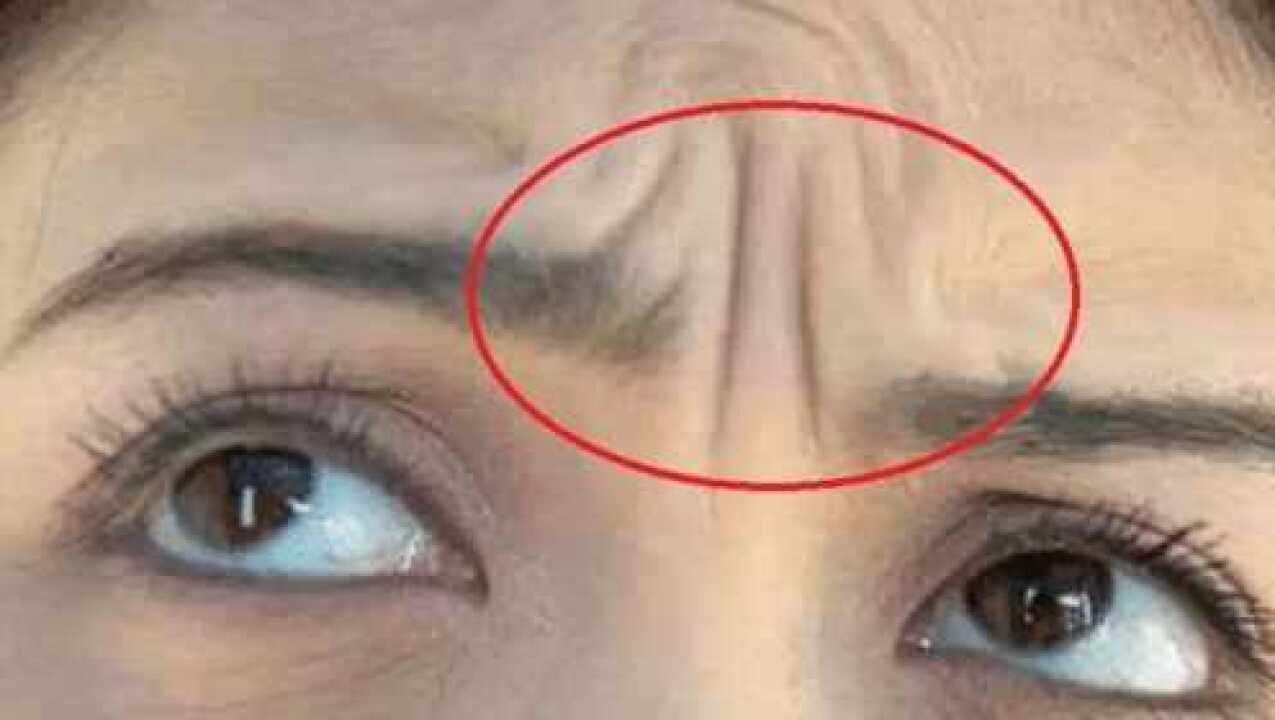 额头上有川字纹注意了这种面相的人命不好看看你有没有中招