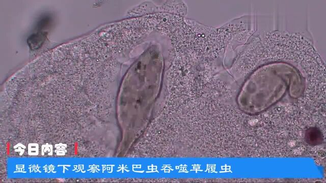 显微镜下观察阿米巴虫吞噬草履虫,原来微观世界也有杀戮