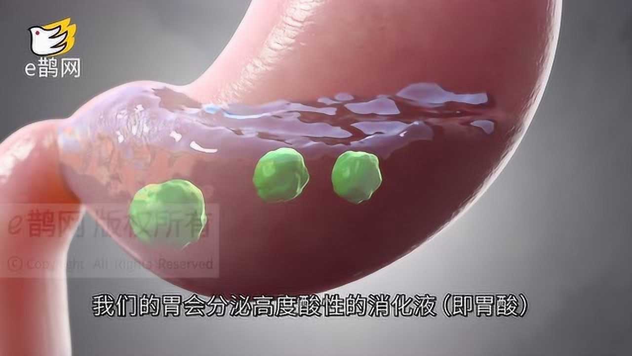 别让胃病癌变,胃溃疡的症状和病因,这些知识你要懂_高清