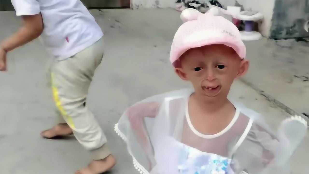8岁女孩患早衰症如外星人,做网红获百万粉丝养活全家