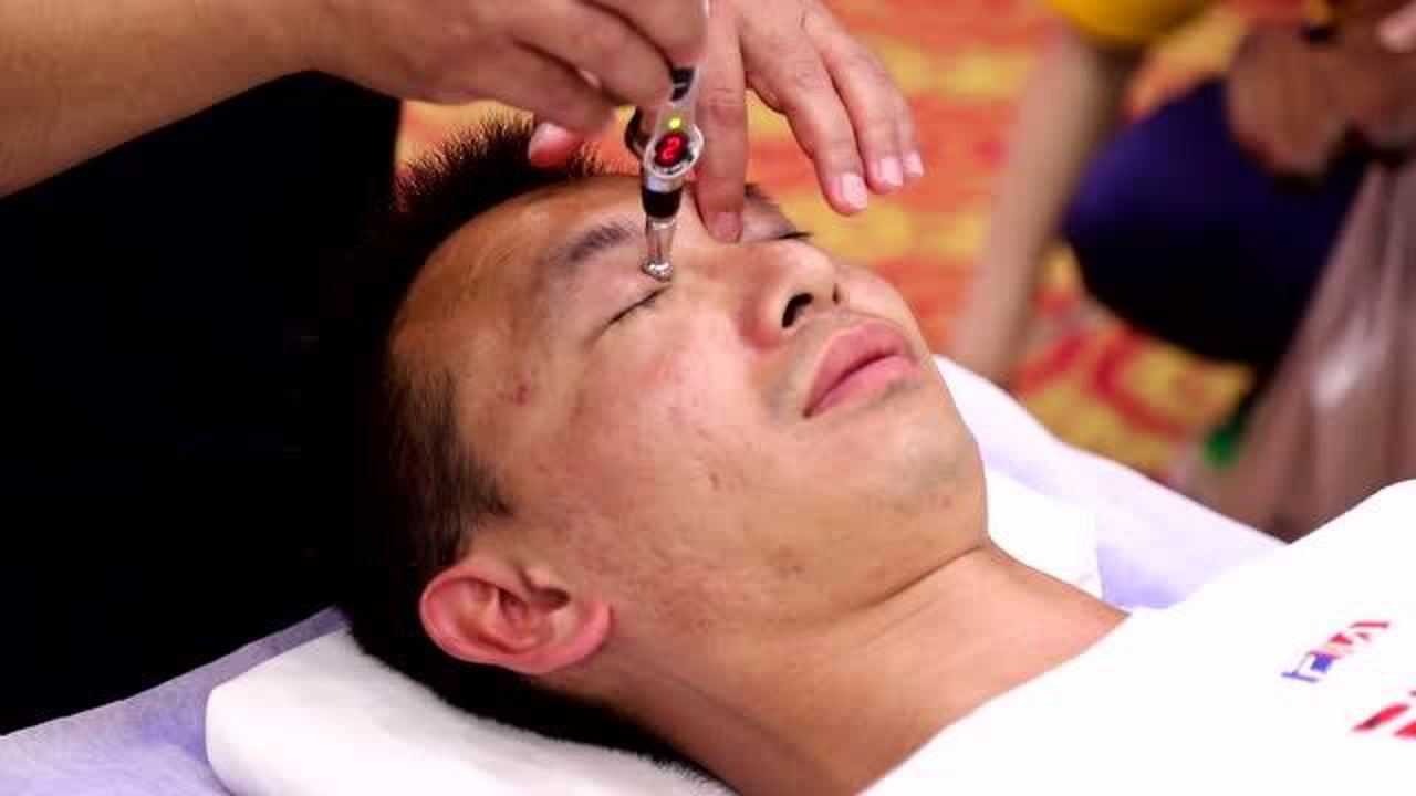 张洪瑞针灸近视眼手法调理近视眼成年青少年都可适用