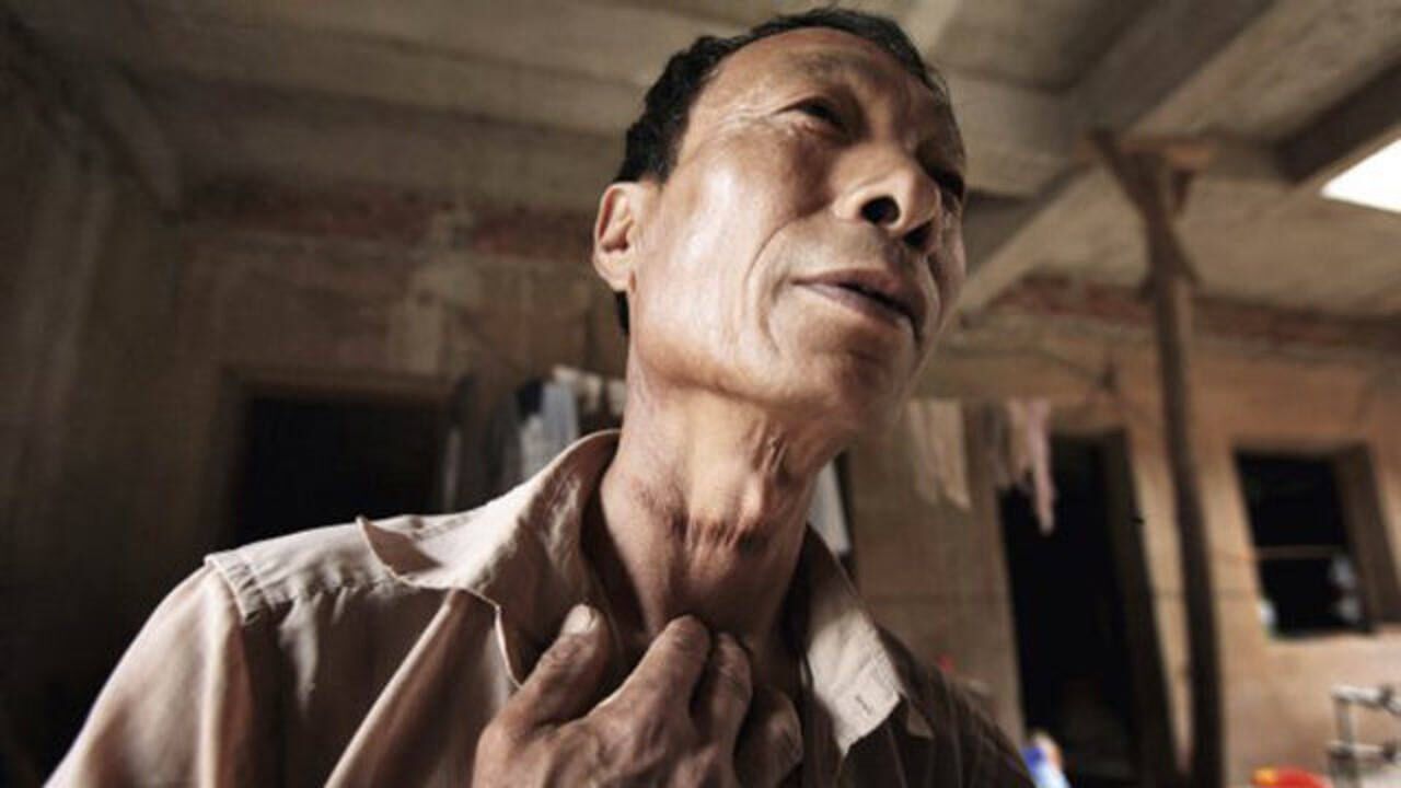 龙治民案件与残疾妻子携手作案家中埋骨48具