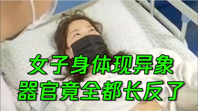 女子腹痛入院医生检查后大吃一惊,器官的位置竟然都和常人相反!