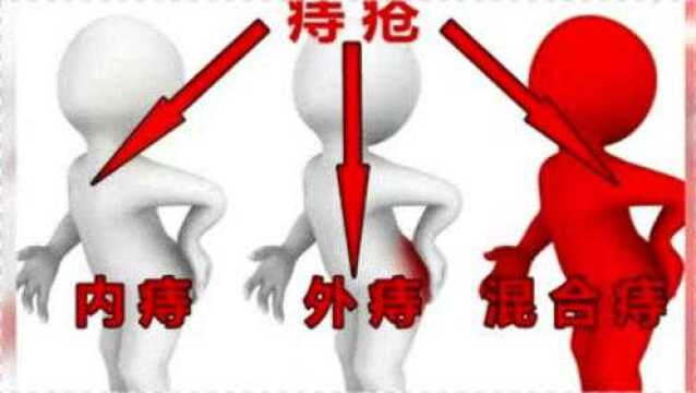 得了内痔疼痛难忍怎么办?医生坦言:三种治疗方案了解下!