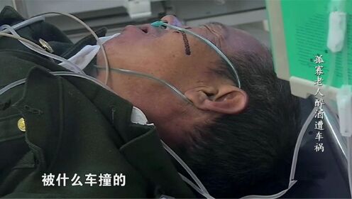 急诊室：男子被集卡碾压，下半身血管全暴露在医生眼前，很是吓人！