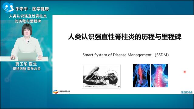 人类认识强直性脊柱炎的历程和里程牌——贾玉华