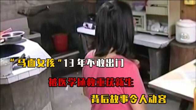 “马面女孩”隐居13年,手术成功完成“换脸”,背后故事令人动容