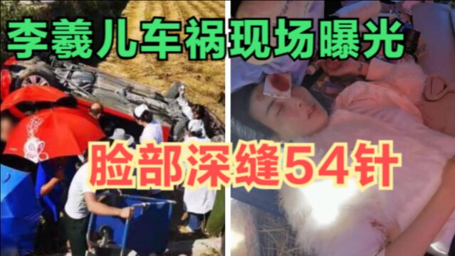 李羲儿车祸现场曝光,脸部缝了54针,本尊医院发视频回应