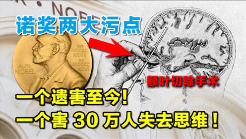 [图]诺贝尔奖的2大污点：一个遗害至今，另一个害30万人失去思维！