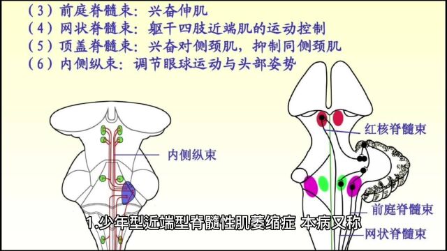 如何鉴别肌营养不良症?