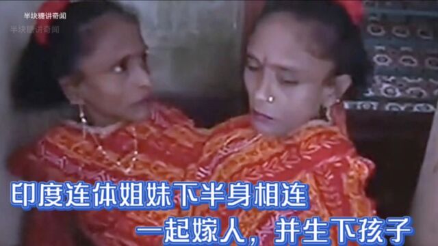 印度连体姐妹下半身相连,一起嫁人,并生下孩子