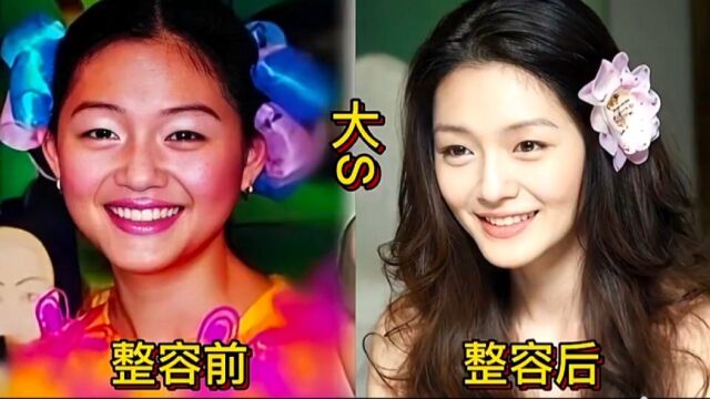 娱乐圈15位整容成功的女星