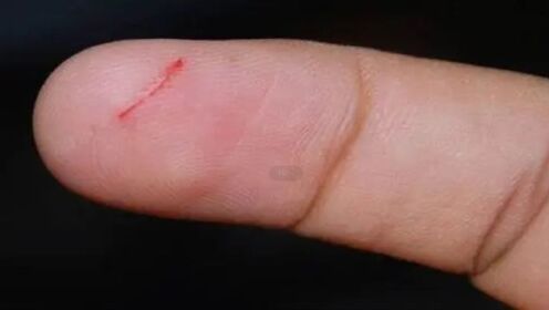 看似平平无奇的纸，手指被它割伤竟然比刀割还要疼？这是什么原因？