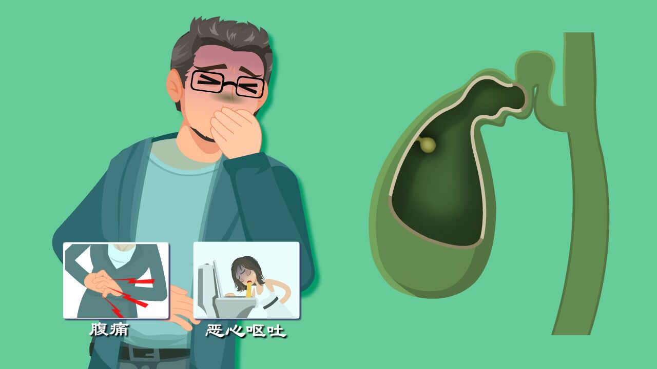 7成患者没症状,癌变率竟达5%?低调的胆囊息肉有啥信号?