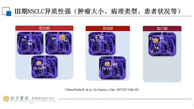 微肿瘤PTC技术在肺癌介入治疗中的应用