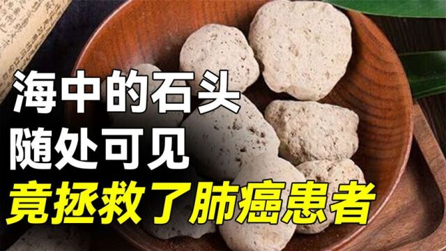 海中的“石头”拯救了肺癌患者?这种石头叫什么?中医文化的精髓