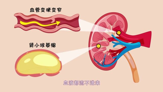 不起眼的高血压,居然是潜伏的“杀手”,一起来看看吧.