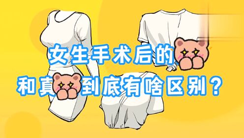 女生手术后的胸，和真胸到底有啥区别？_高清