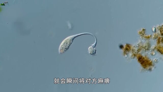 大开眼界的微生物世界二