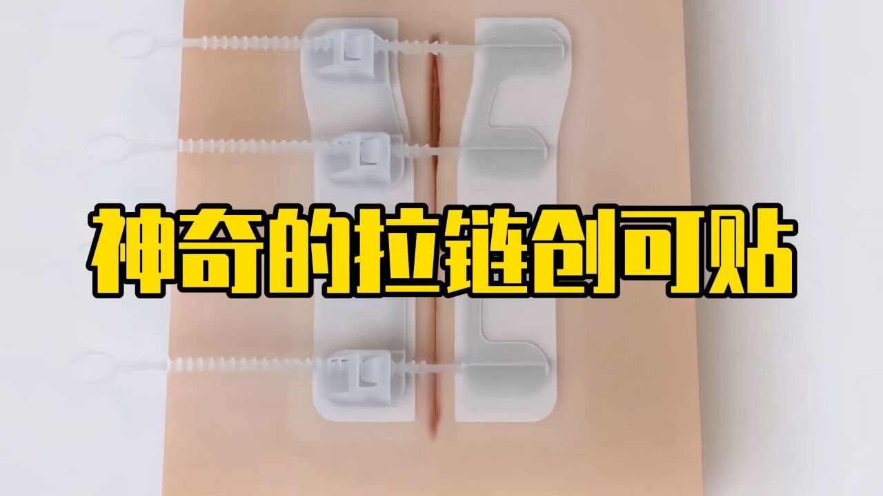 神奇的拉链式创可贴