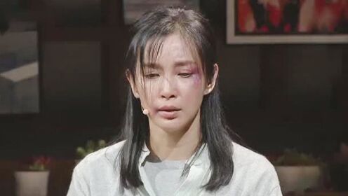 李冰冰遭家暴鼻青眼肿,报警不敢说话