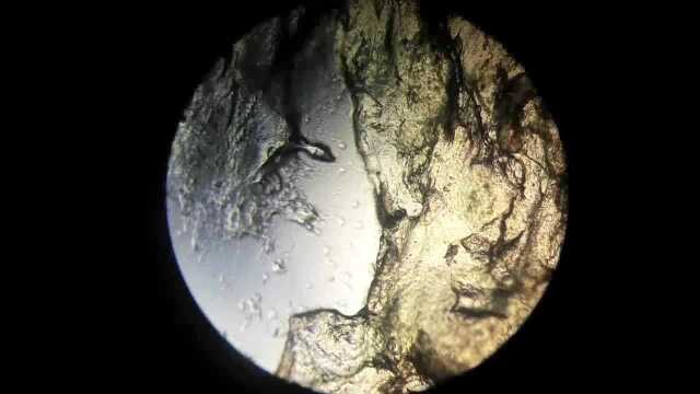 科普显微下的鼻屎有多脏掏完请洗手