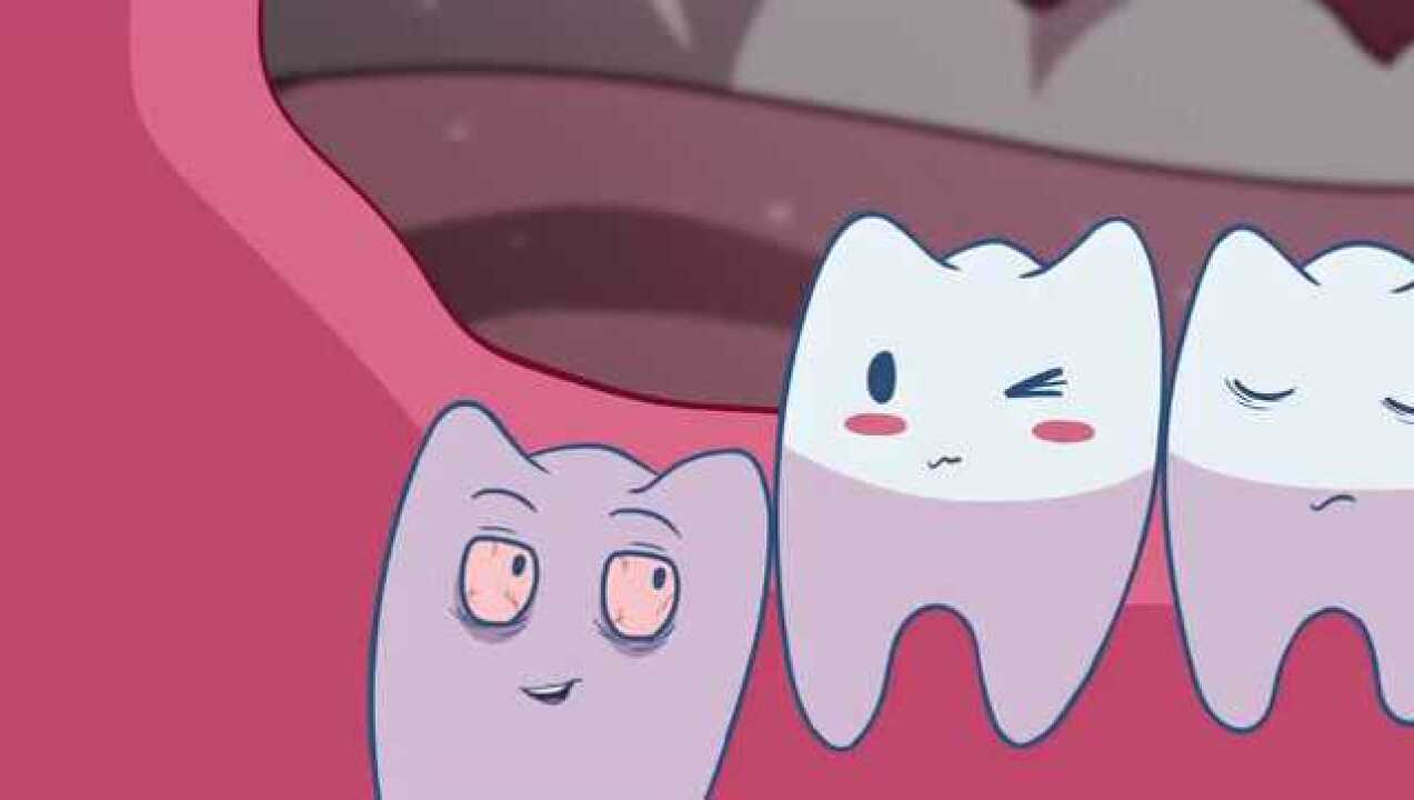 动画解析智齿的生长过程，看看你智齿要拔掉吗？_高清