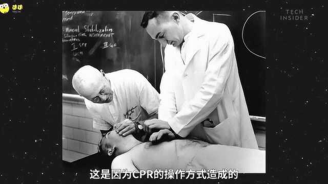 关于CPR心肺复苏术 你所需要了解的