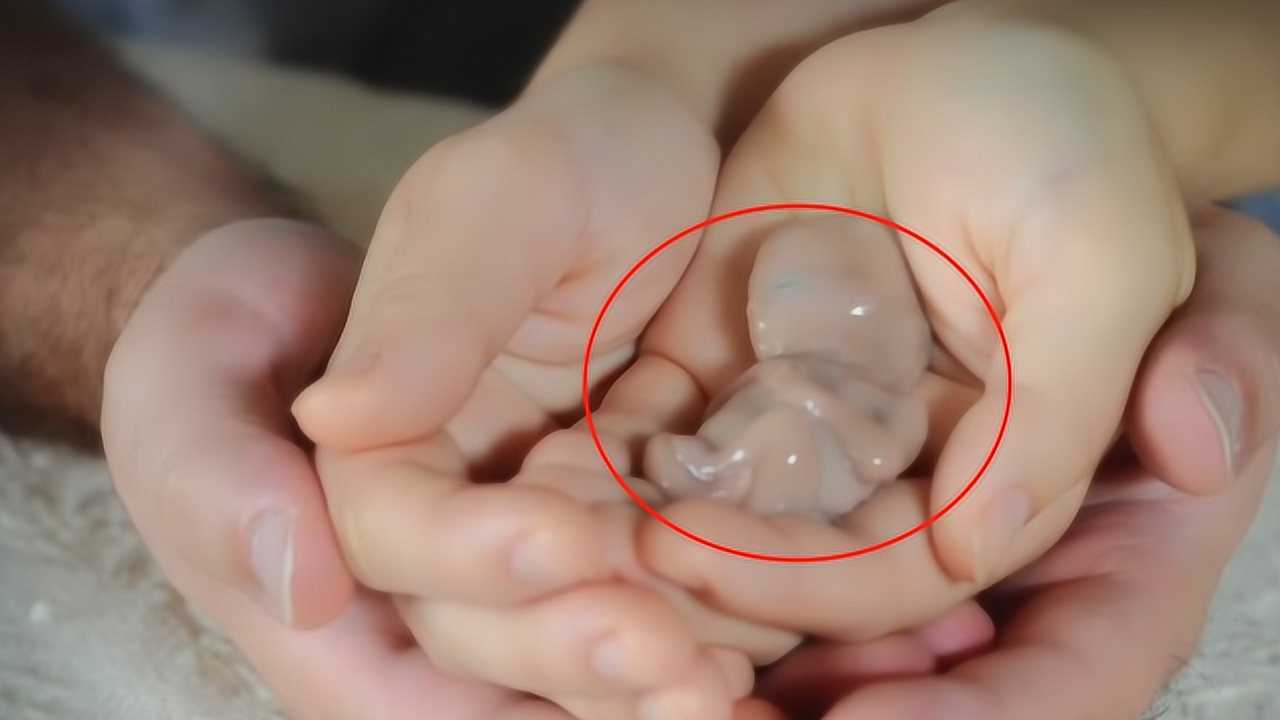 人流手术是如何“打胎”的，3D动画还原全过程，看完不寒而栗！_高清