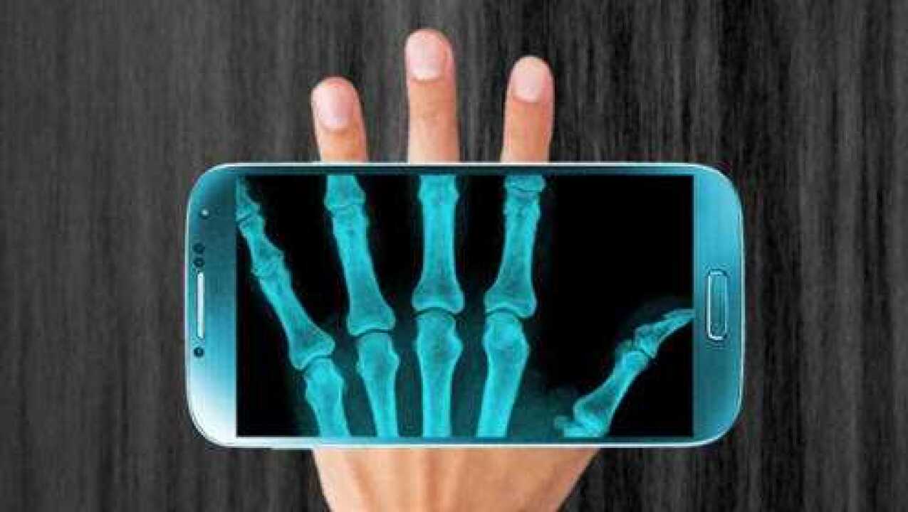 教你开启手机"x光透视"功能,屏幕秒变扫描仪,实用又方便