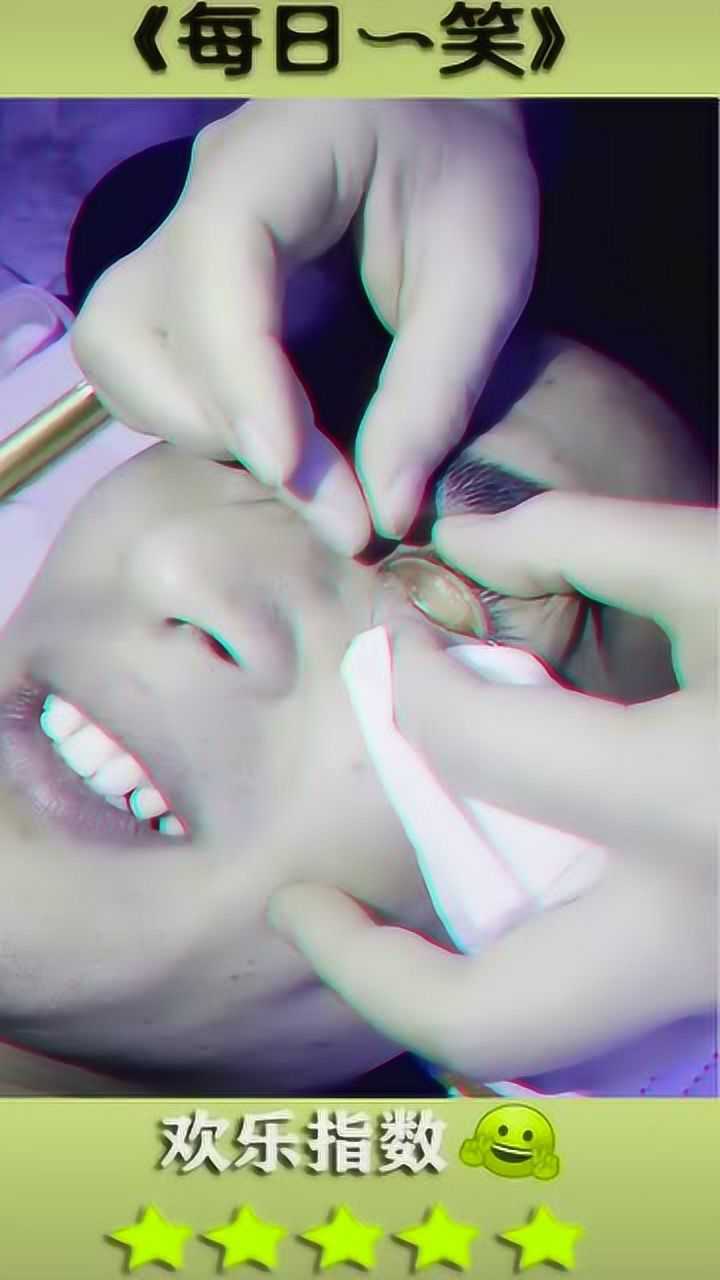 专业洗眼师是这样洗眼睛的长见识了