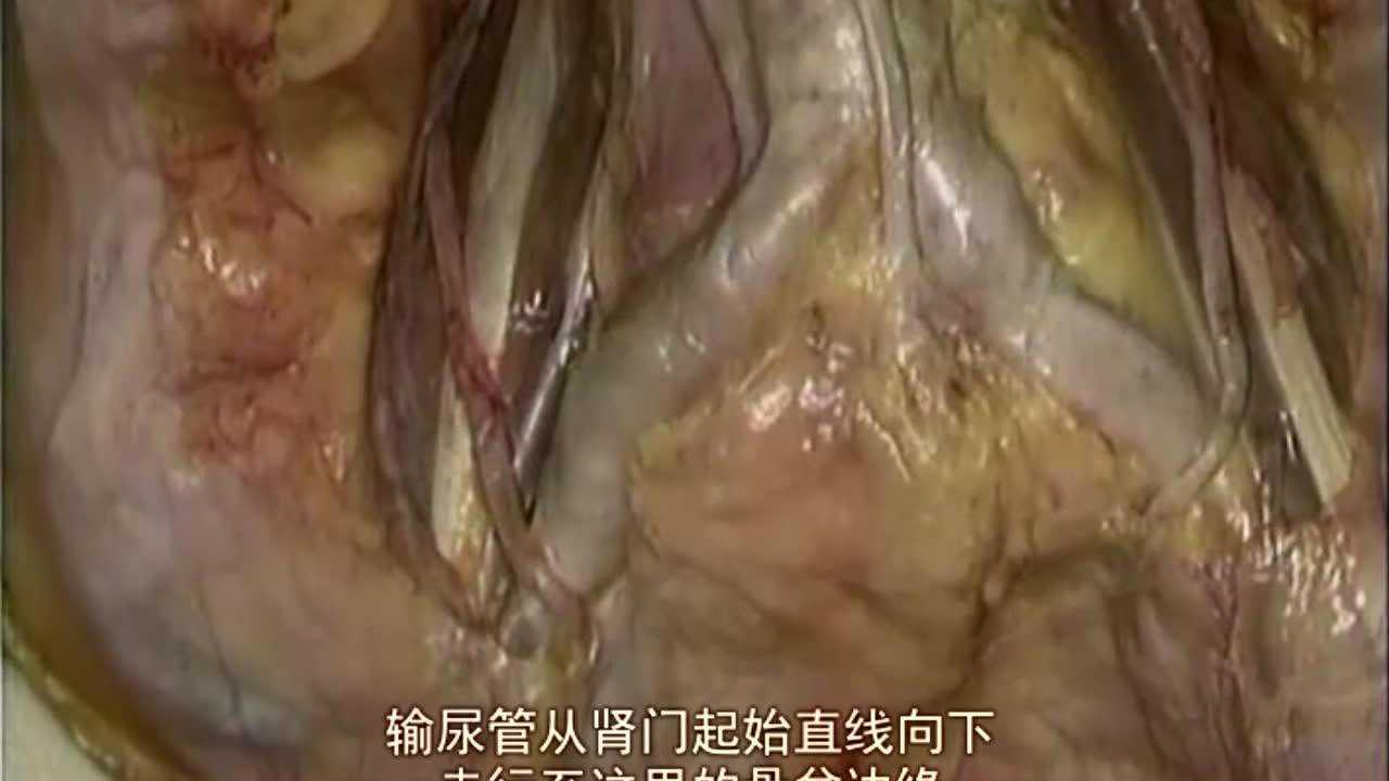 人体输尿管的解剖位置_高清