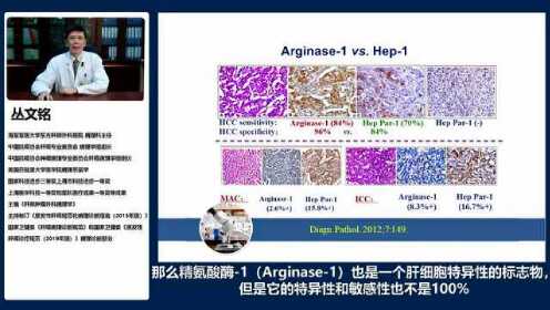 终稿-会选会用会看-丛文铭教授带你读懂肝癌免疫组化诊断